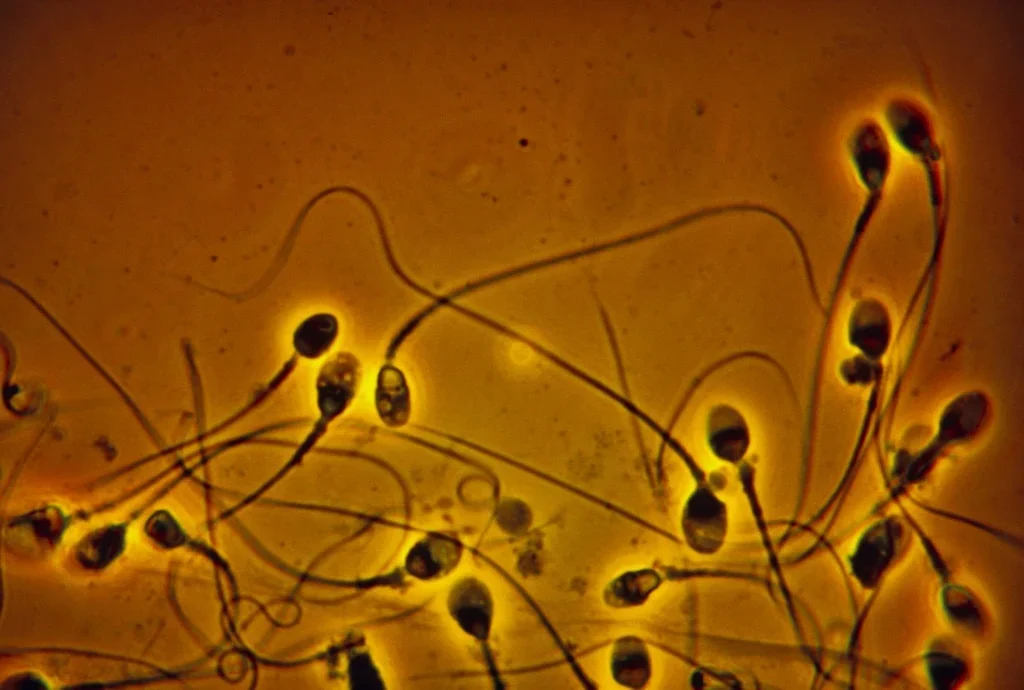 “Sperm Count in Western Men Has Dropped Over 50 Percent Since 1973, Paper Finds “