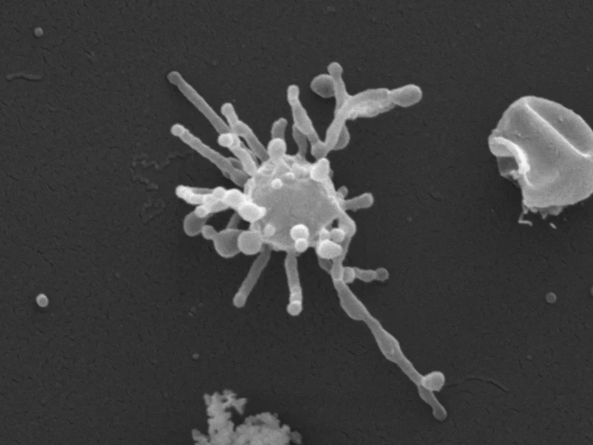 Massive tentacled microbe may be direct ancestor of all complex life | Live Science￼